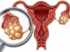 How can you get cervical cancer​